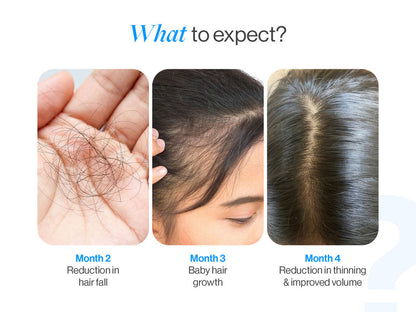 Advanced Hair Growth Serum